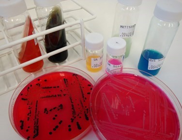 red samples in petri dishes