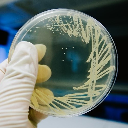 Image of agar plate growing bacteria