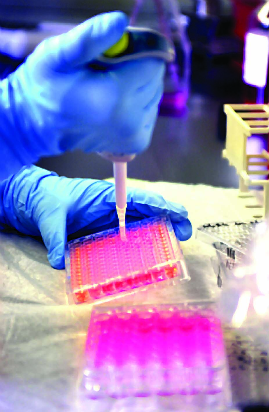 tray of samples being filled with a pipette 